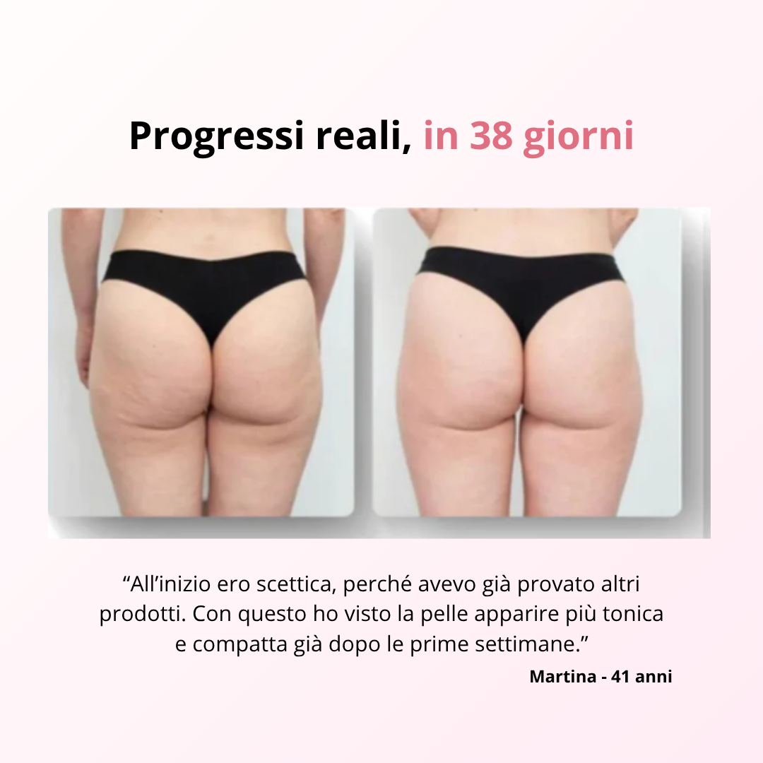 VelvetSkin™ - Massaggiatore anti-cellulite Delicato
