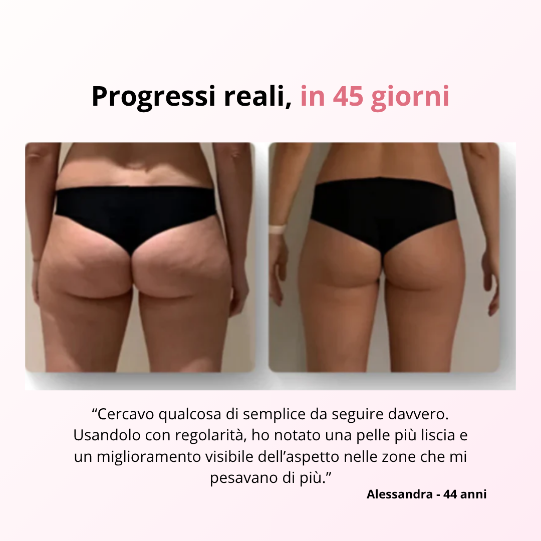 VelvetSkin™ - Massaggiatore anti-cellulite Delicato