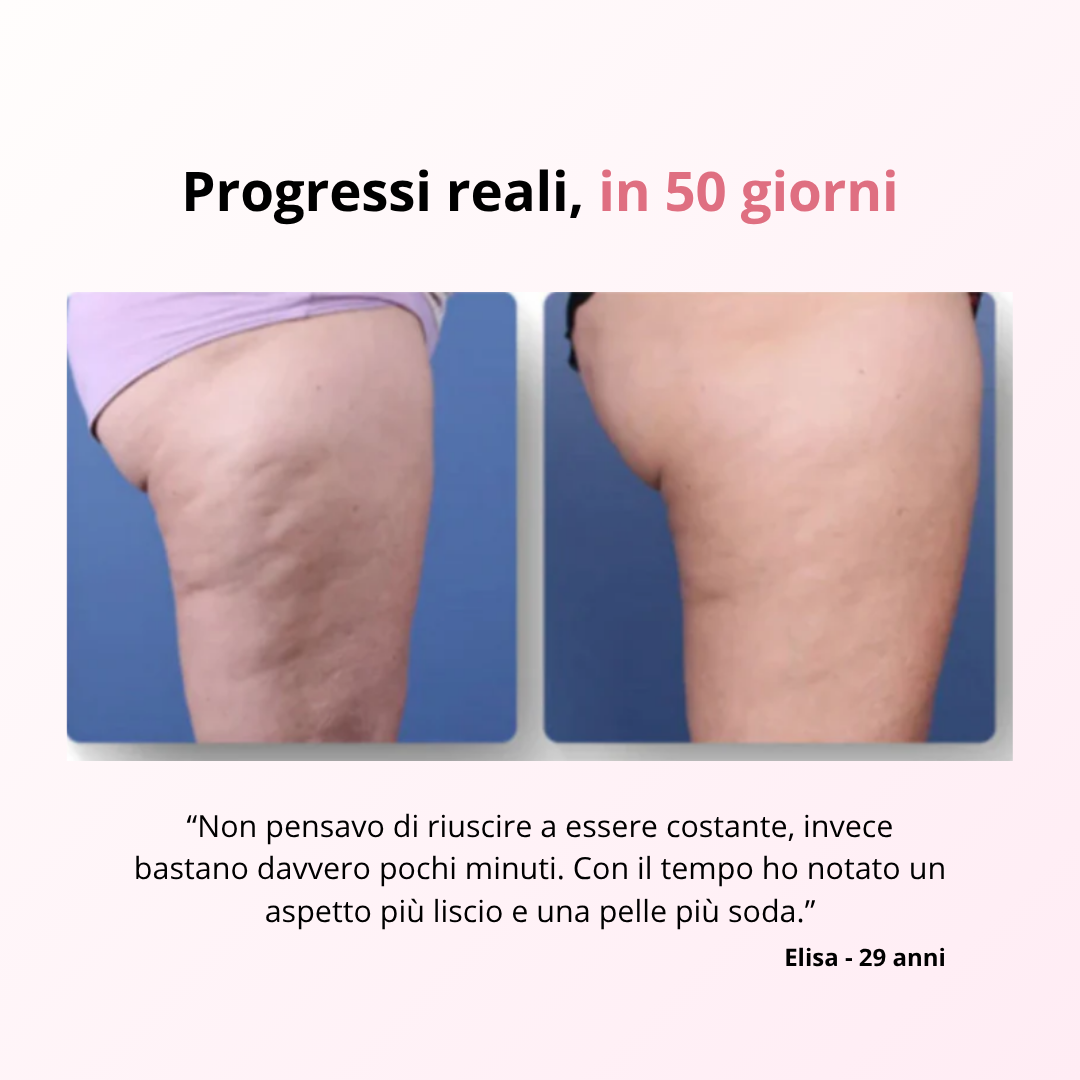 VelvetSkin™ - Massaggiatore anti-cellulite Delicato